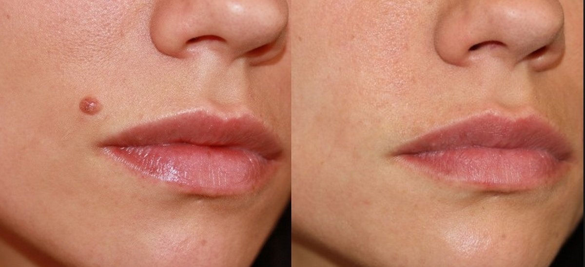 The Green Room - Bournemouth Clinic - The Green Room - Bournemouth Clinic