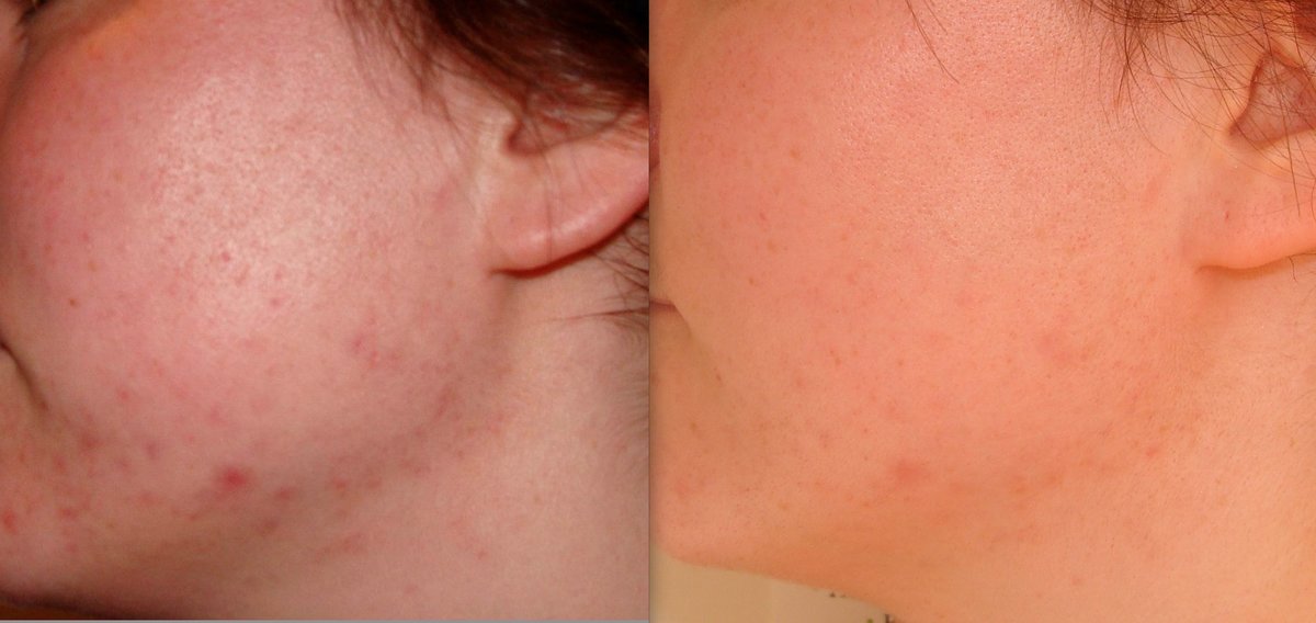 The Green Room - Bournemouth Clinic - The Green Room - Bournemouth Clinic