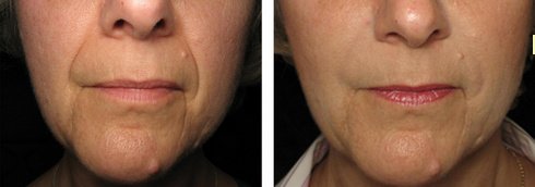 The Green Room - Bournemouth Clinic - The Green Room - Bournemouth Clinic