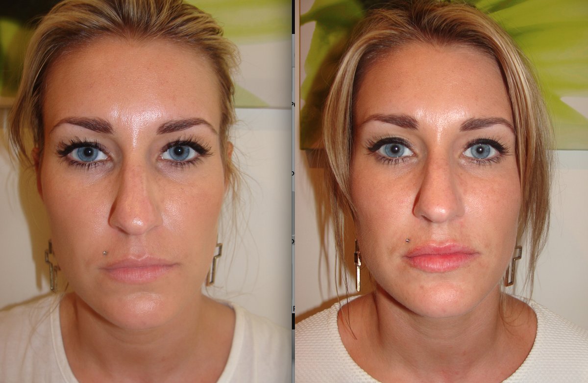 The Green Room - Bournemouth Clinic - The Green Room - Bournemouth Clinic