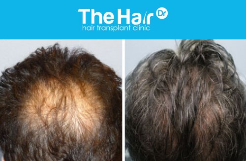 The Hair Dr - The Hair Dr