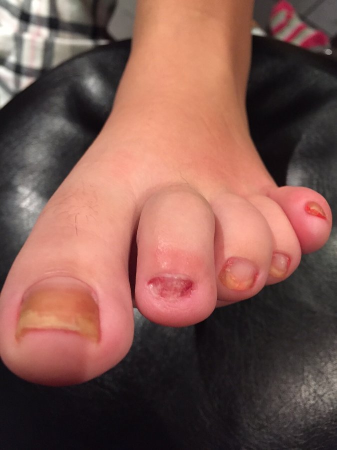 The Harley Medical Foot and Nail Laser Clinic: Marion Yau - The Harley Medical Foot and Nail Laser Clinic: Marion Yau