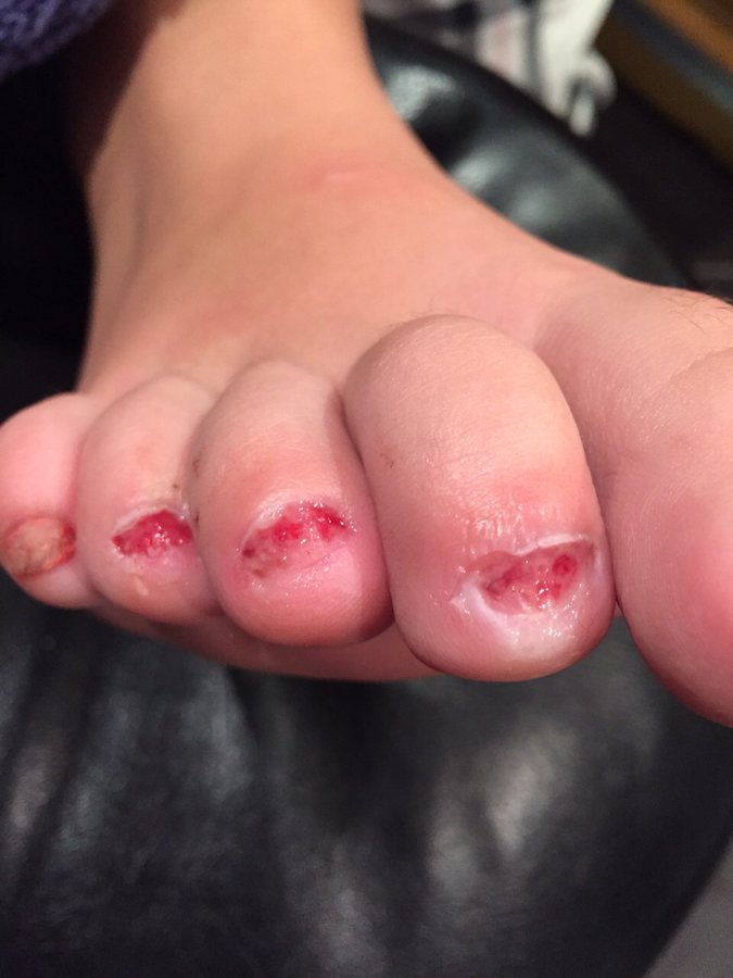 The Harley Medical Foot and Nail Laser Clinic: Marion Yau - The Harley Medical Foot and Nail Laser Clinic: Marion Yau