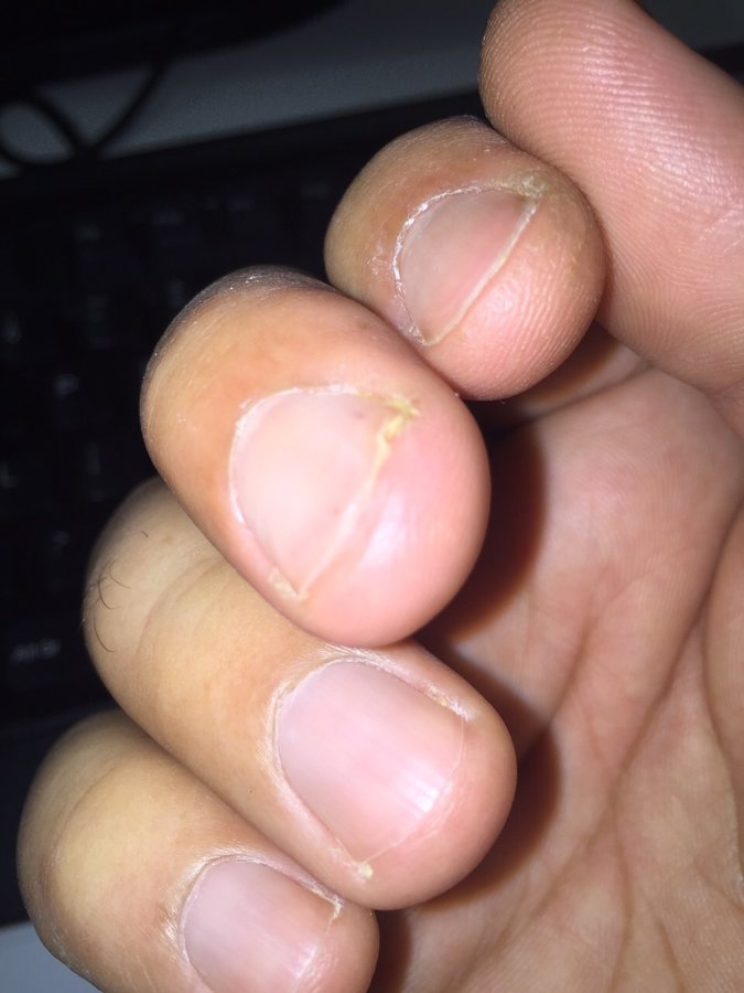 The Harley Medical Foot and Nail Laser Clinic: Marion Yau - The Harley Medical Foot and Nail Laser Clinic: Marion Yau