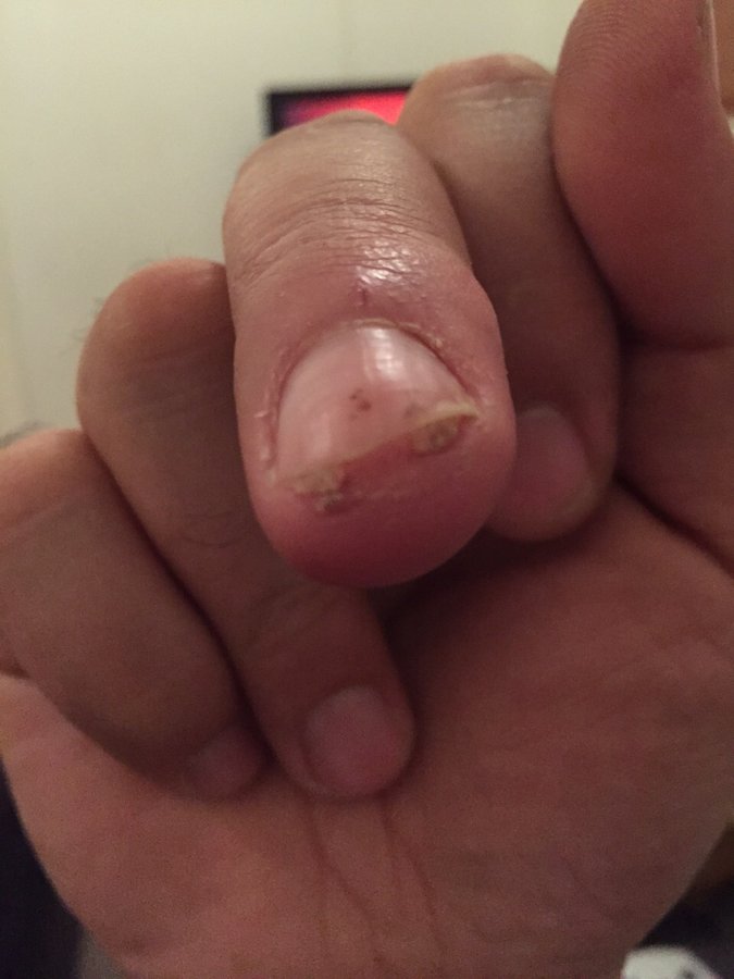 The Harley Medical Foot and Nail Laser Clinic: Marion Yau - The Harley Medical Foot and Nail Laser Clinic: Marion Yau