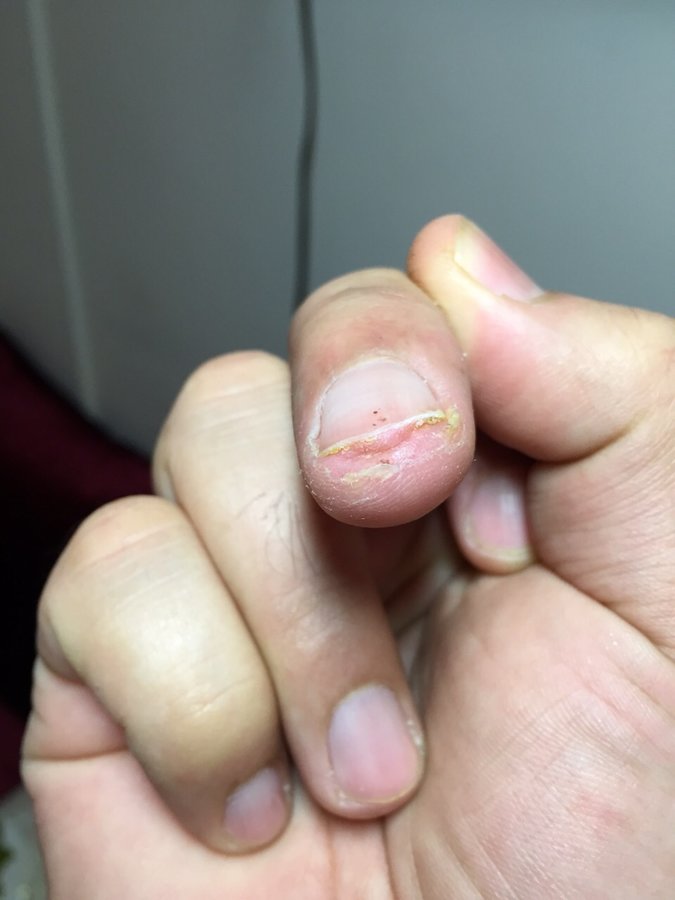 The Harley Medical Foot and Nail Laser Clinic: Marion Yau - The Harley Medical Foot and Nail Laser Clinic: Marion Yau