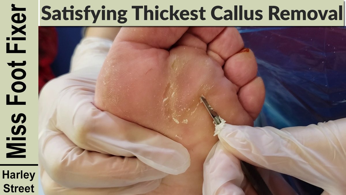 The Harley Medical Foot and Nail Laser Clinic: Marion Yau - The Harley Medical Foot and Nail Laser Clinic: Marion Yau