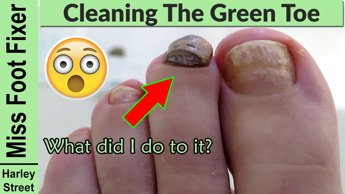 The Harley Medical Foot and Nail Laser Clinic: Marion Yau - The Harley Medical Foot and Nail Laser Clinic: Marion Yau