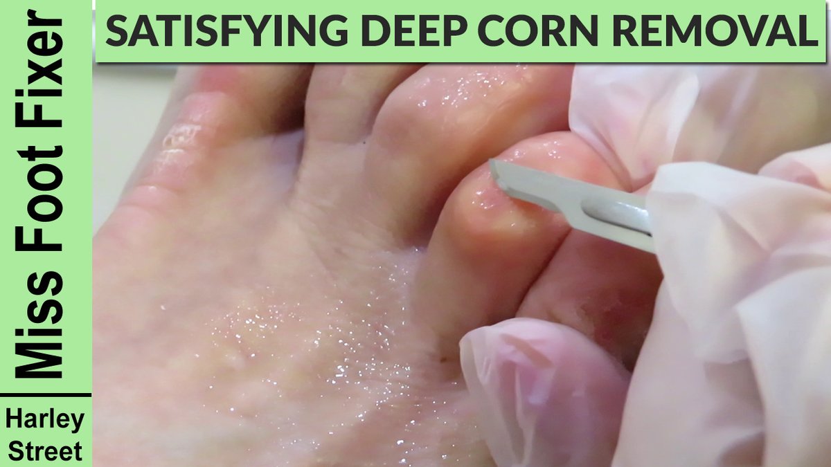 The Harley Medical Foot and Nail Laser Clinic: Marion Yau - The Harley Medical Foot and Nail Laser Clinic: Marion Yau