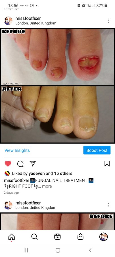 The Harley Medical Foot and Nail Laser Clinic: Marion Yau - The Harley Medical Foot and Nail Laser Clinic: Marion Yau