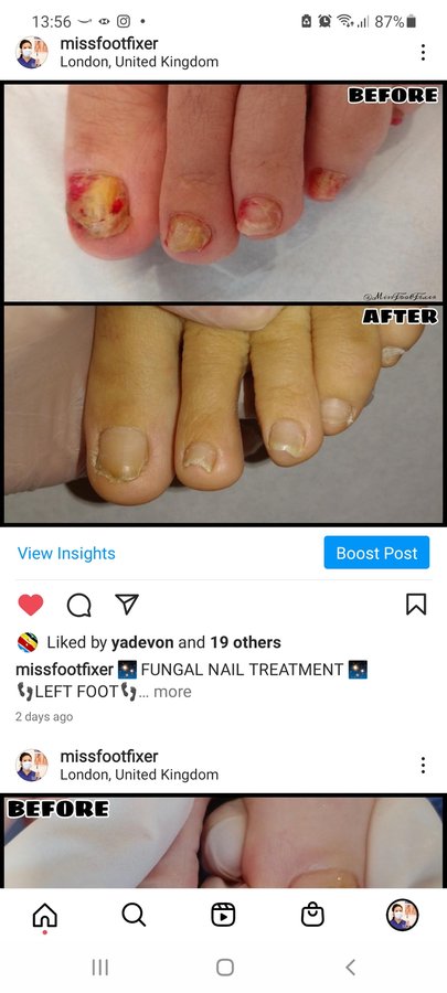 The Harley Medical Foot and Nail Laser Clinic: Marion Yau - The Harley Medical Foot and Nail Laser Clinic: Marion Yau