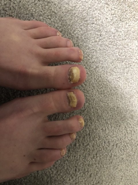 The Harley Medical Foot and Nail Laser Clinic: Marion Yau - The Harley Medical Foot and Nail Laser Clinic: Marion Yau