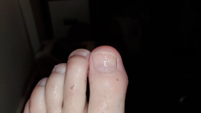 The Harley Medical Foot and Nail Laser Clinic: Marion Yau - The Harley Medical Foot and Nail Laser Clinic: Marion Yau