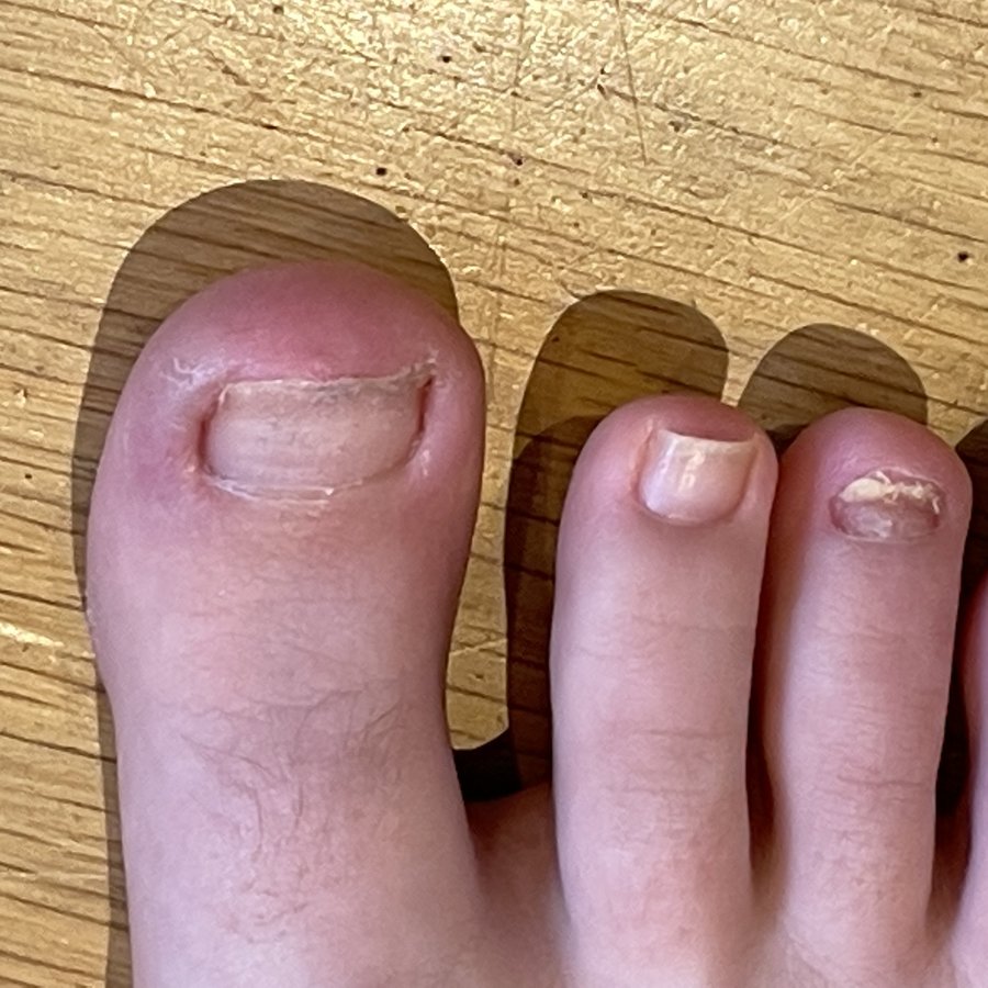 The Harley Medical Foot and Nail Laser Clinic: Marion Yau - The Harley Medical Foot and Nail Laser Clinic: Marion Yau