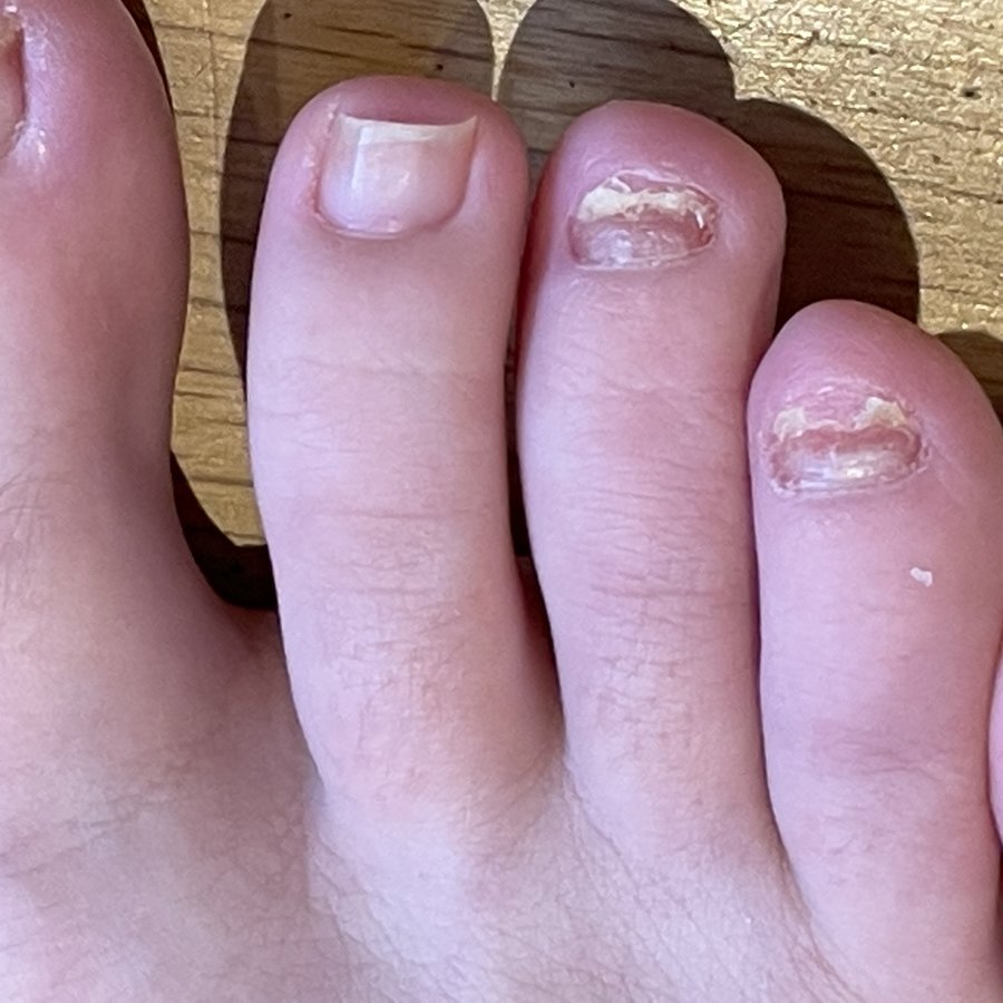 The Harley Medical Foot and Nail Laser Clinic: Marion Yau - The Harley Medical Foot and Nail Laser Clinic: Marion Yau