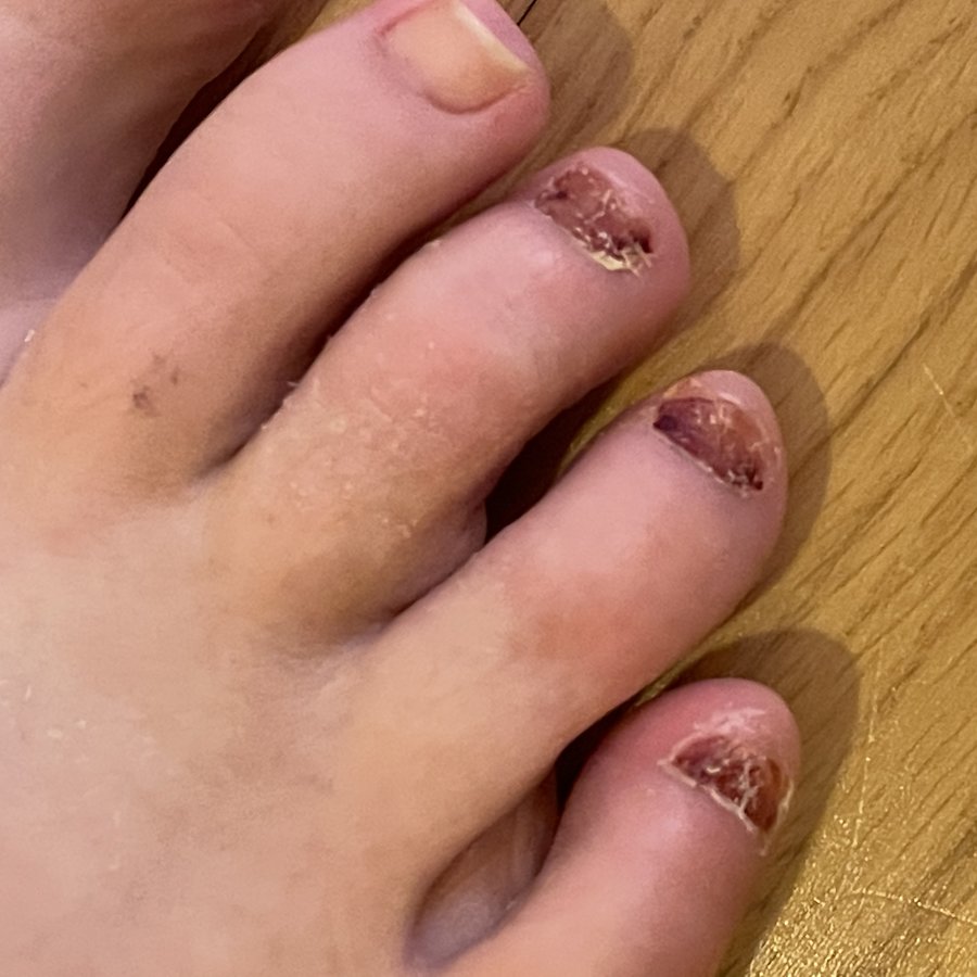 The Harley Medical Foot and Nail Laser Clinic: Marion Yau - The Harley Medical Foot and Nail Laser Clinic: Marion Yau