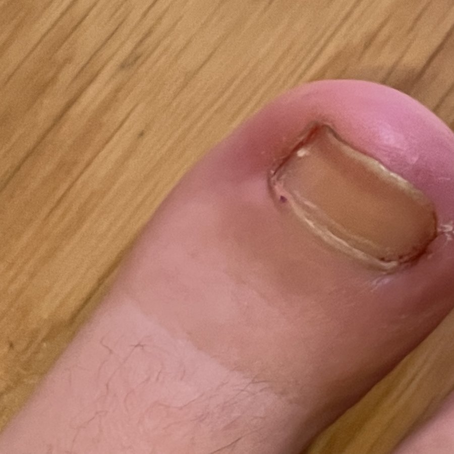 The Harley Medical Foot and Nail Laser Clinic: Marion Yau - The Harley Medical Foot and Nail Laser Clinic: Marion Yau