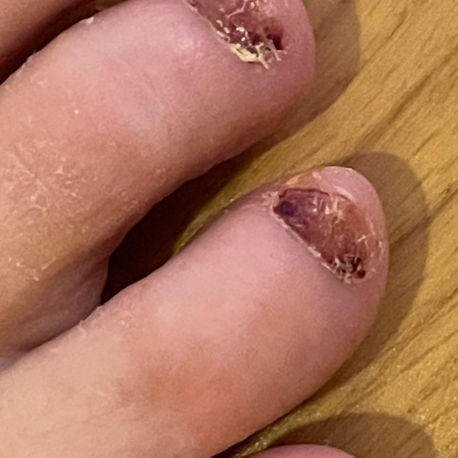 The Harley Medical Foot and Nail Laser Clinic: Marion Yau - The Harley Medical Foot and Nail Laser Clinic: Marion Yau