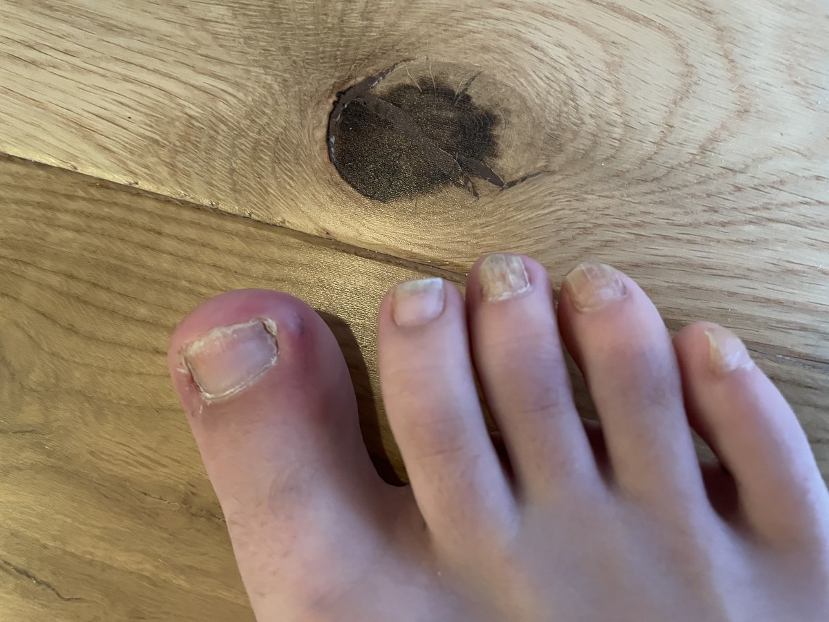 The Harley Medical Foot and Nail Laser Clinic: Marion Yau - The Harley Medical Foot and Nail Laser Clinic: Marion Yau