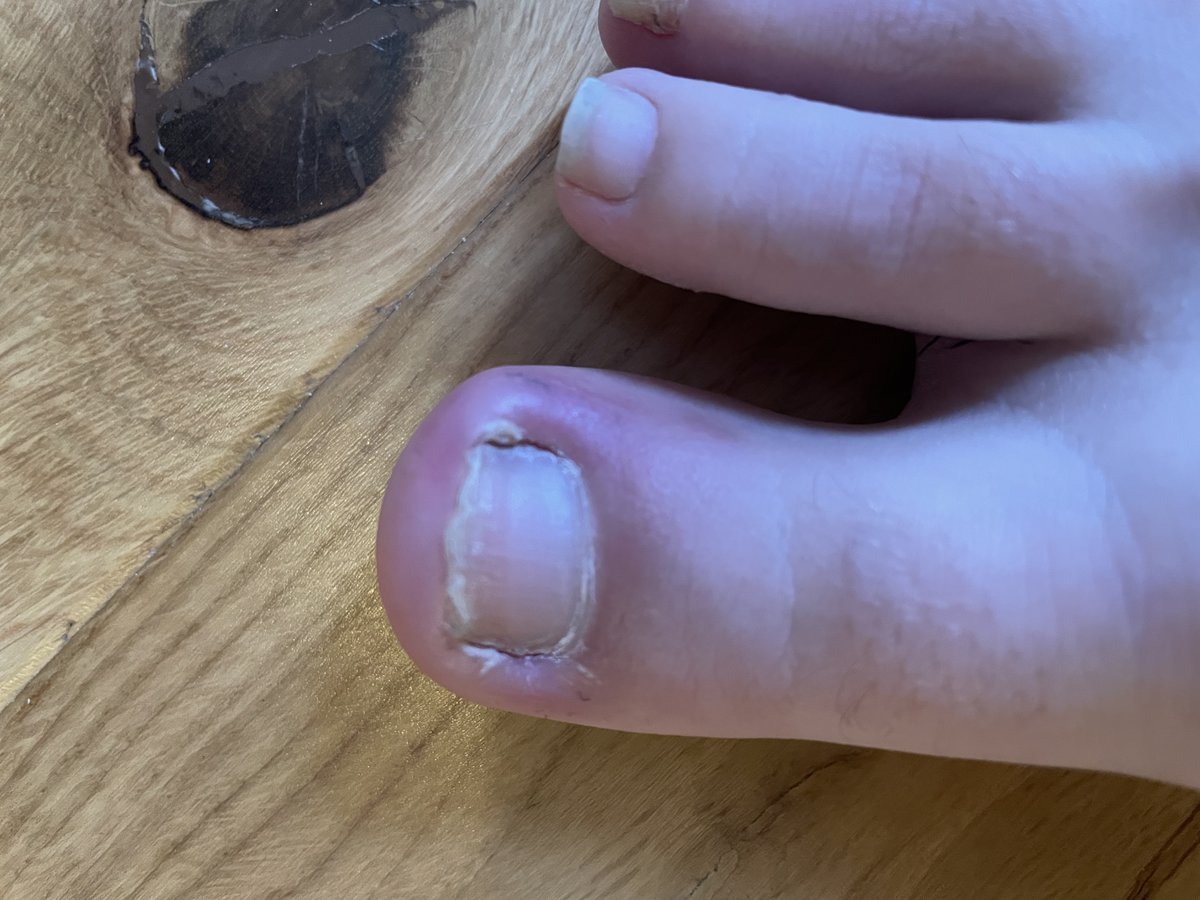 The Harley Medical Foot and Nail Laser Clinic: Marion Yau - The Harley Medical Foot and Nail Laser Clinic: Marion Yau