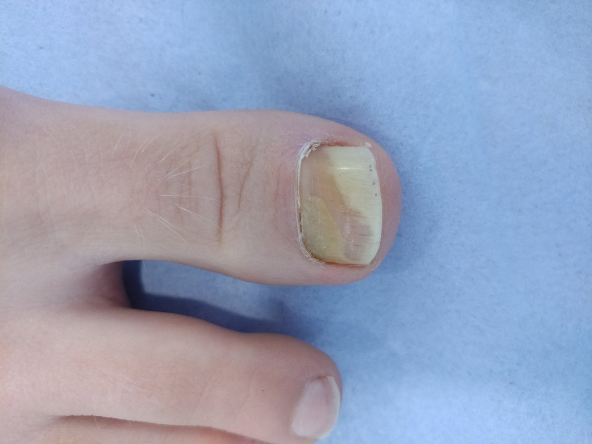 The Harley Medical Foot and Nail Laser Clinic: Marion Yau - The Harley Medical Foot and Nail Laser Clinic: Marion Yau