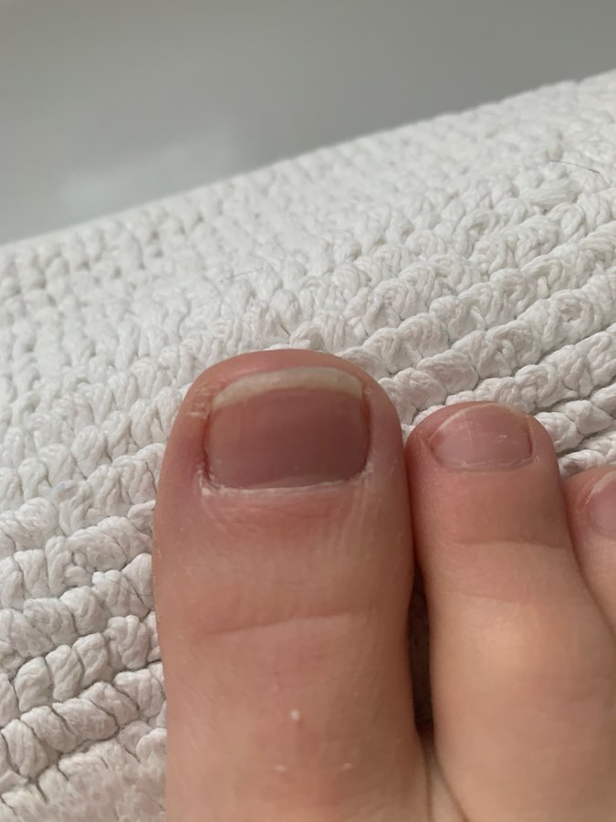 The Harley Medical Foot and Nail Laser Clinic: Marion Yau - The Harley Medical Foot and Nail Laser Clinic: Marion Yau