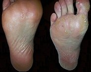 The Harley Medical Foot and Nail Laser Clinic: Marion Yau - The Harley Medical Foot and Nail Laser Clinic: Marion Yau