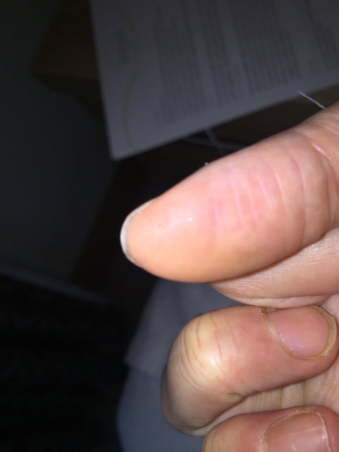 The Harley Medical Foot and Nail Laser Clinic: Marion Yau - The Harley Medical Foot and Nail Laser Clinic: Marion Yau