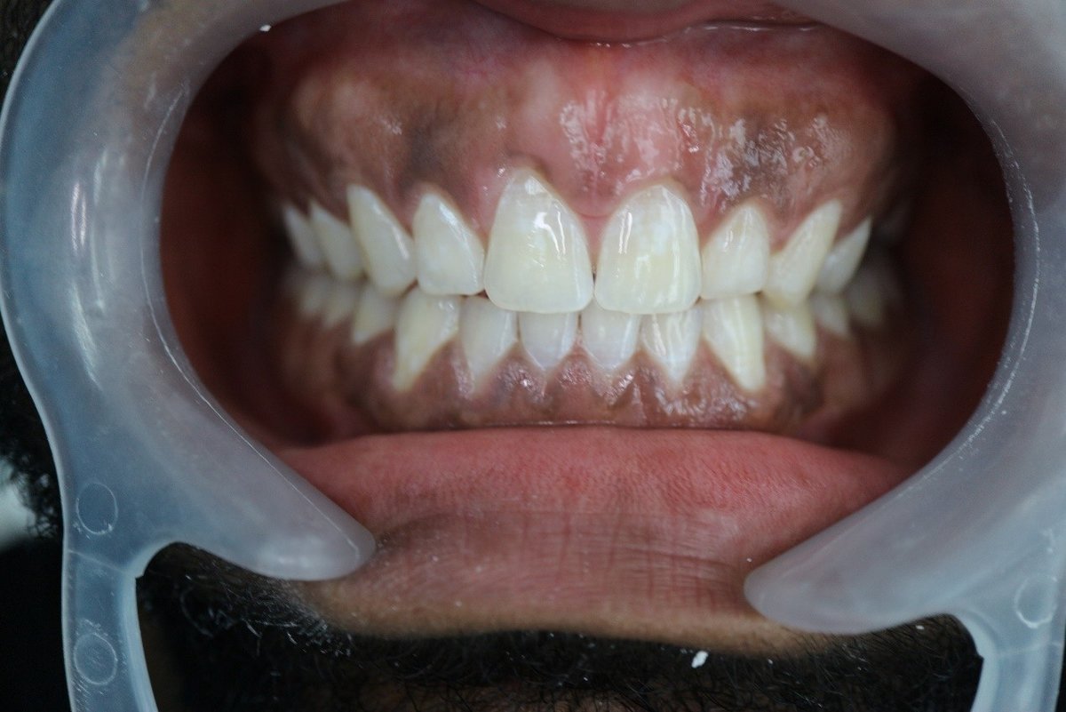 The Hong Kong Japanese Dental Clinic - The Hong Kong Japanese Dental Clinic