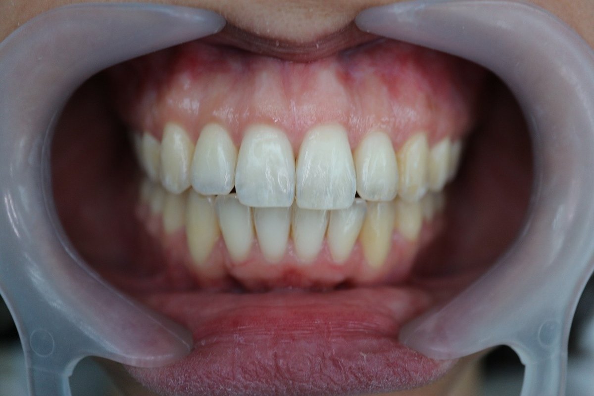 The Hong Kong Japanese Dental Clinic - The Hong Kong Japanese Dental Clinic