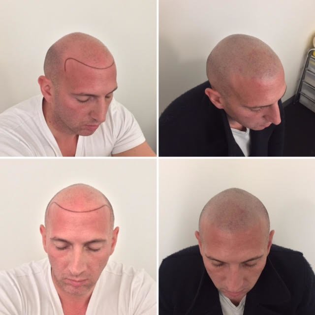 The Look SMP Clinic - The Look SMP Clinic