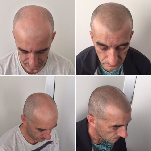 The Look SMP Clinic - The Look SMP Clinic