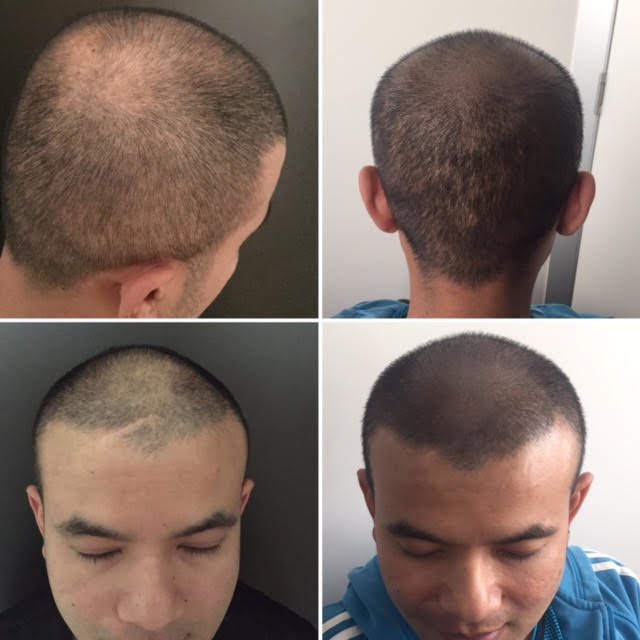 The Look SMP Clinic - The Look SMP Clinic