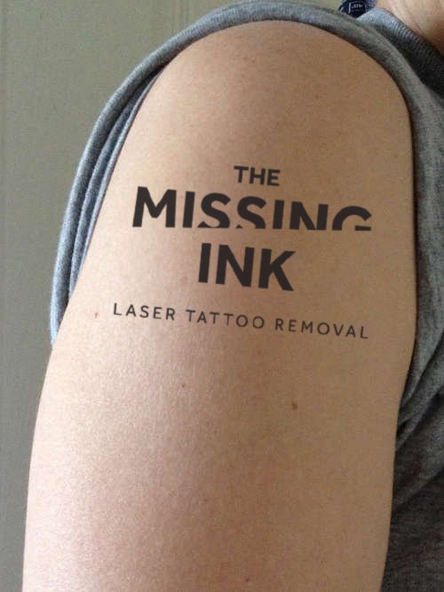 The Missing Ink: Laser Tattoo Removal - The Missing Ink: Laser Tattoo Removal