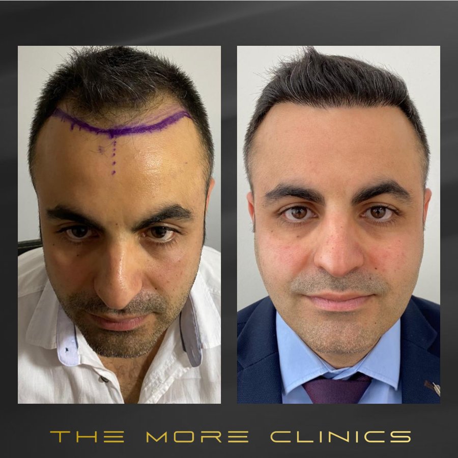 The More Clinics - The More Clinics
