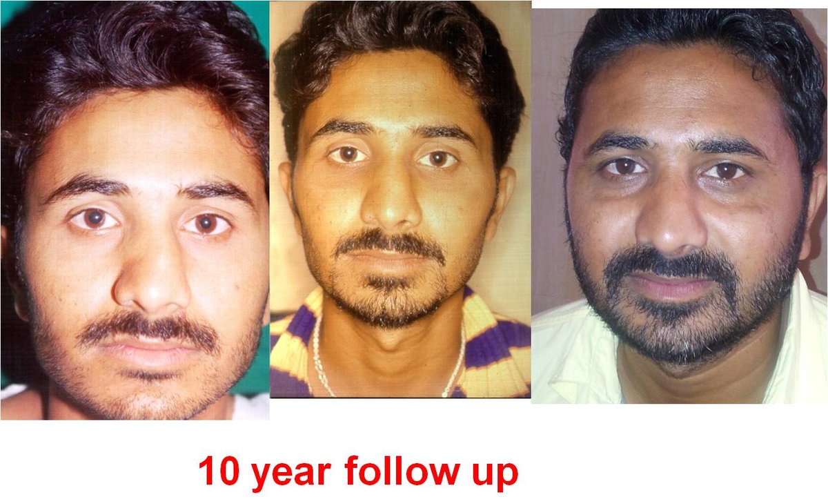 The Nose Clinic - The Nose Clinic