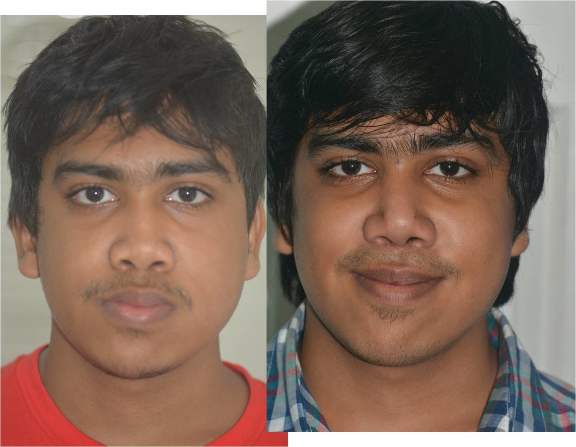 The Nose Clinic - The Nose Clinic