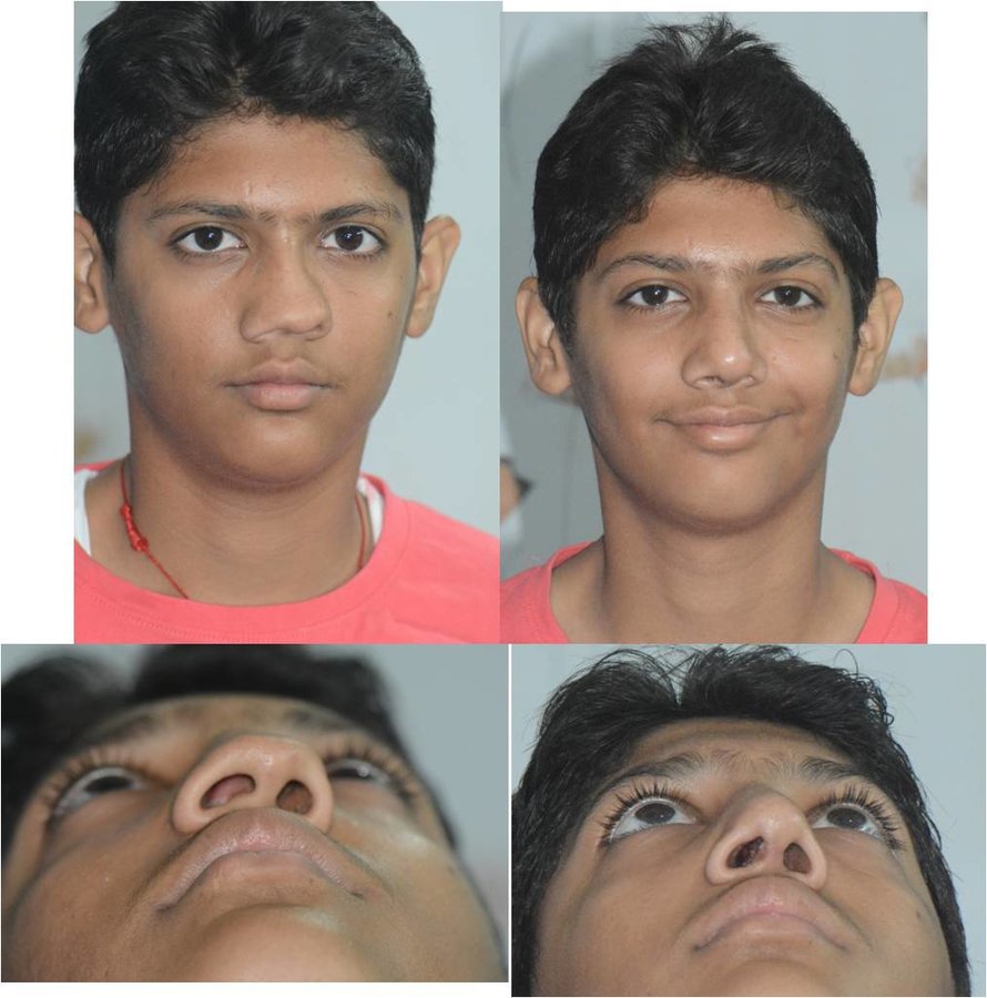 The Nose Clinic - The Nose Clinic