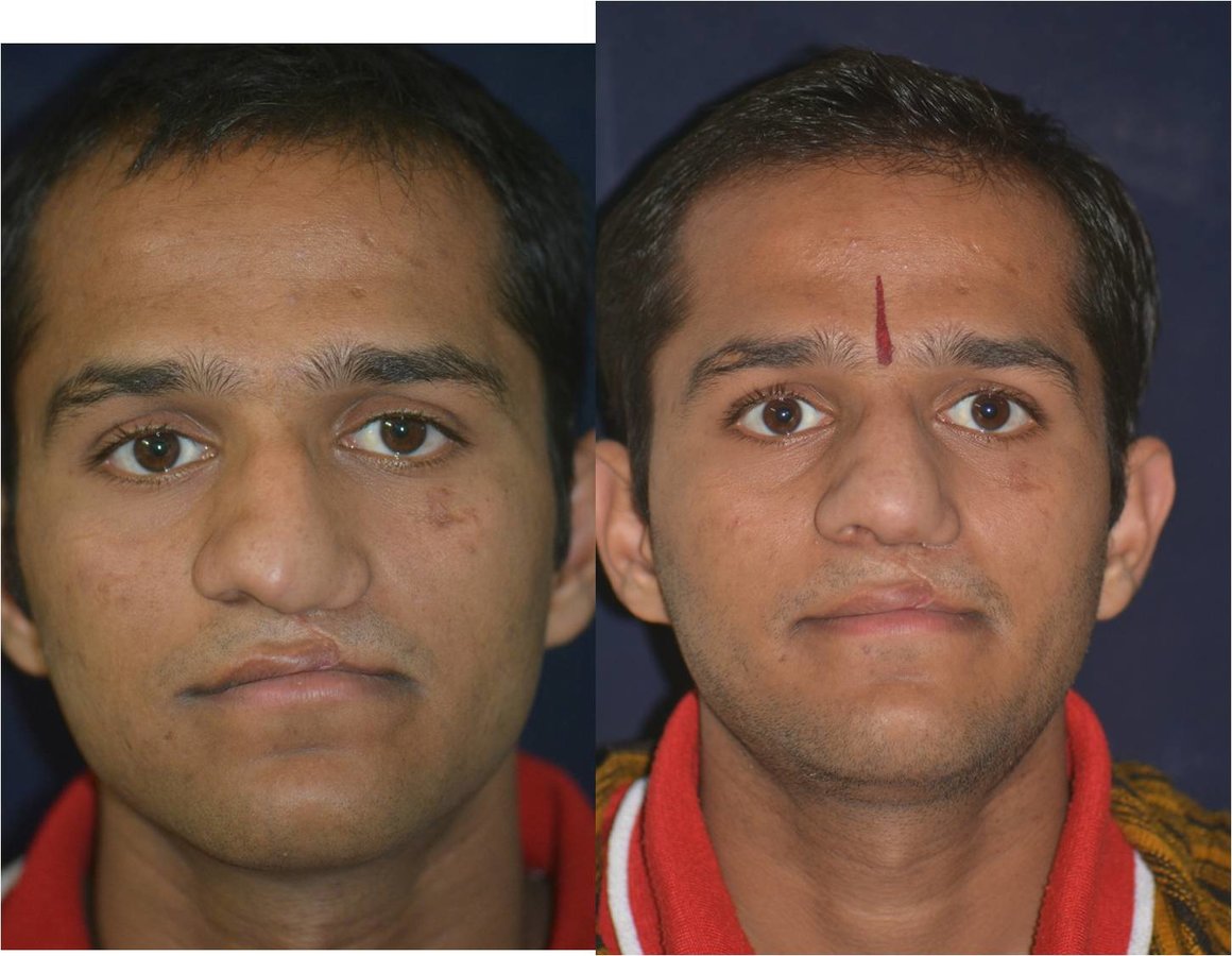 The Nose Clinic - The Nose Clinic