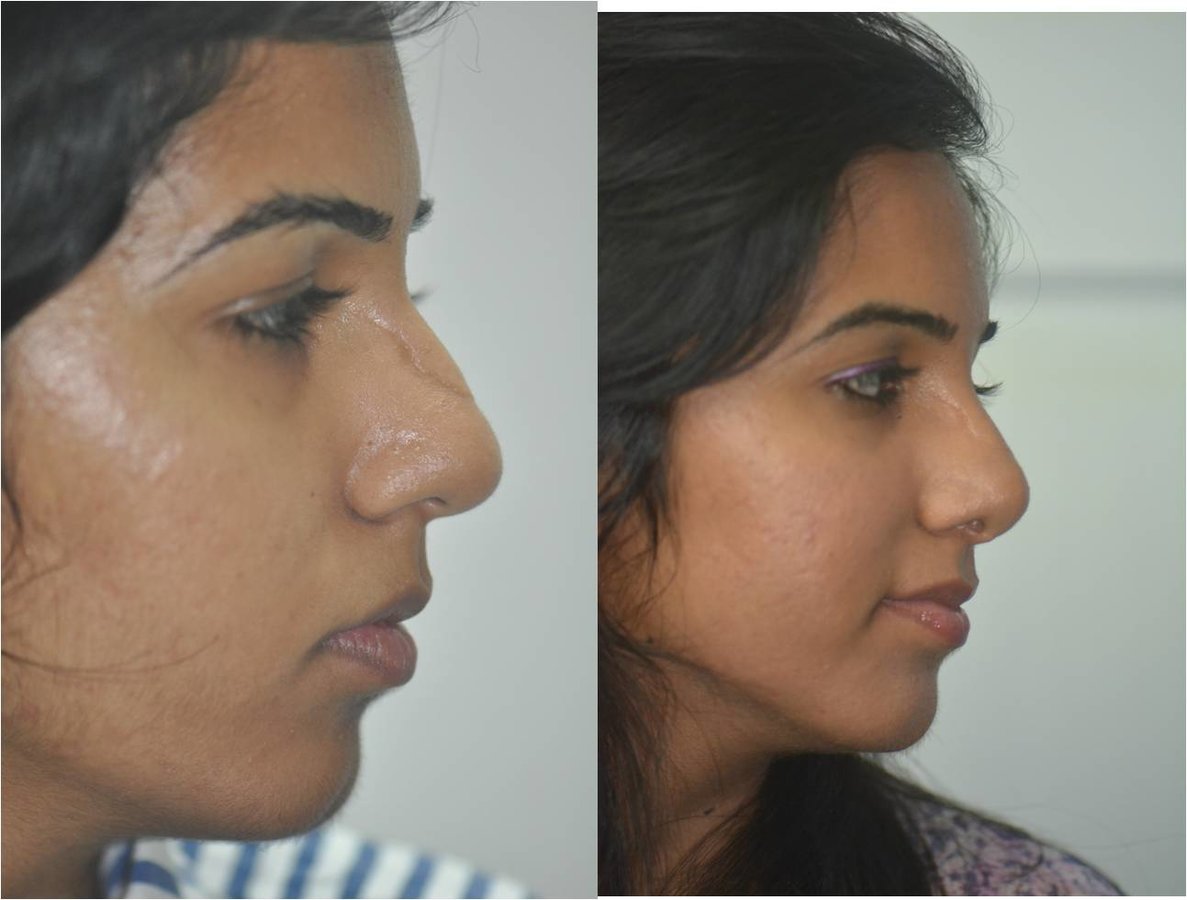 The Nose Clinic - The Nose Clinic