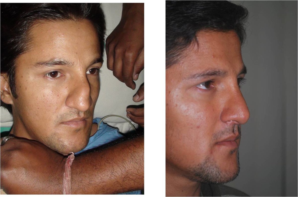 The Nose Clinic - The Nose Clinic