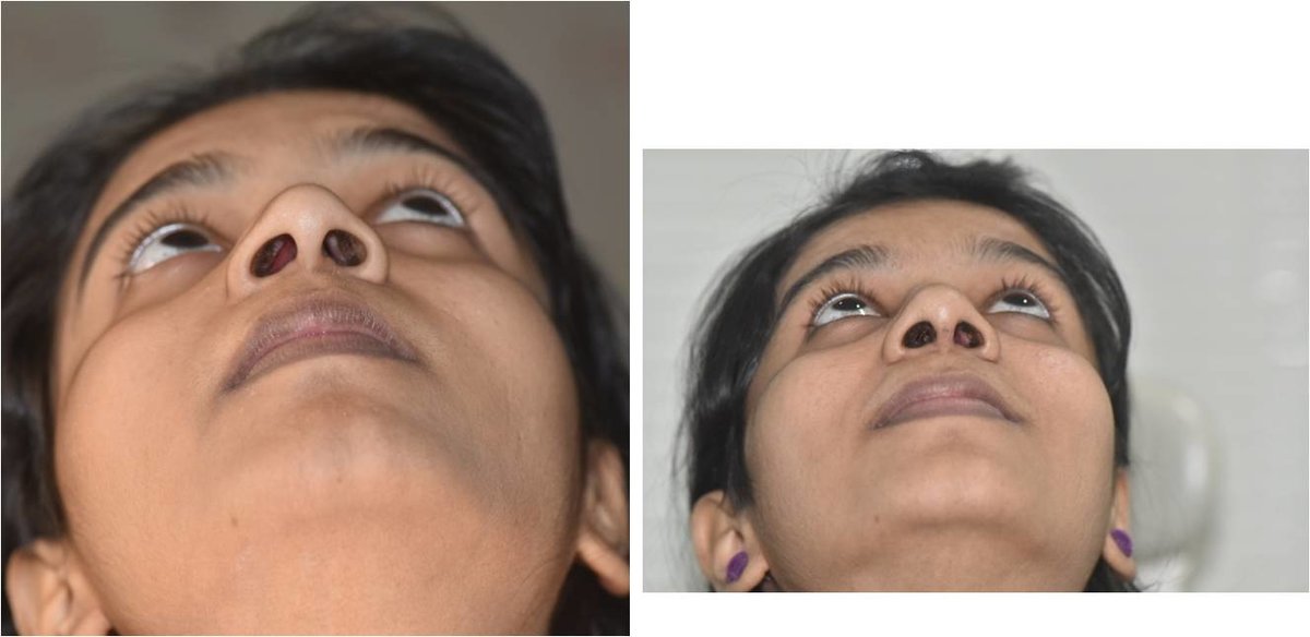 The Nose Clinic - The Nose Clinic