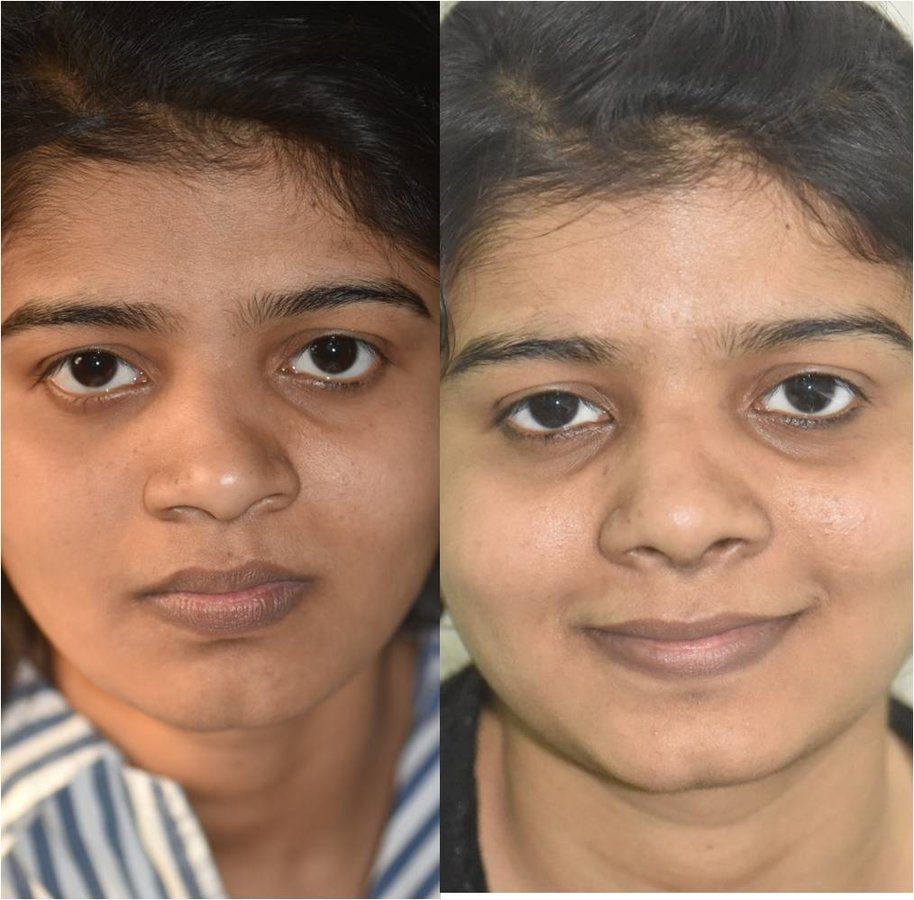 The Nose Clinic - The Nose Clinic