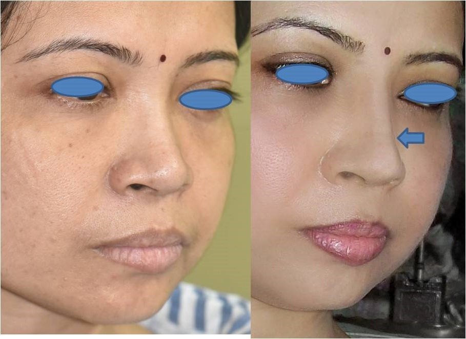 The Nose Clinic - The Nose Clinic