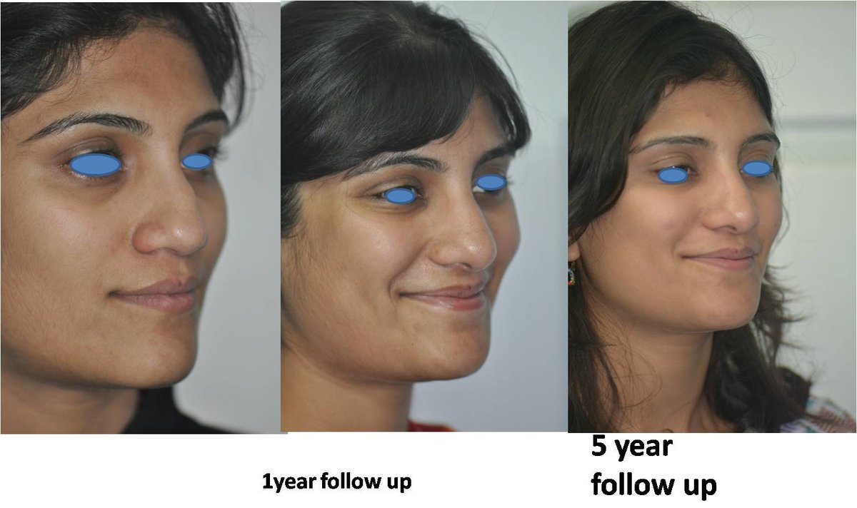 The Nose Clinic - The Nose Clinic