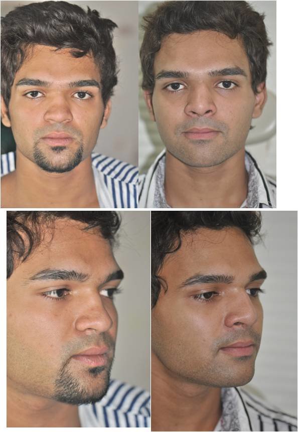 The Nose Clinic - The Nose Clinic