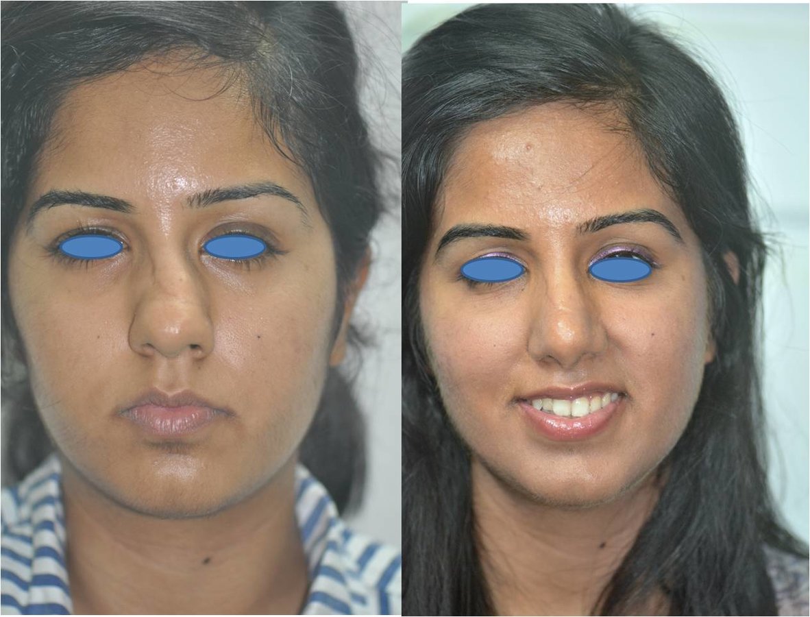 The Nose Clinic - The Nose Clinic