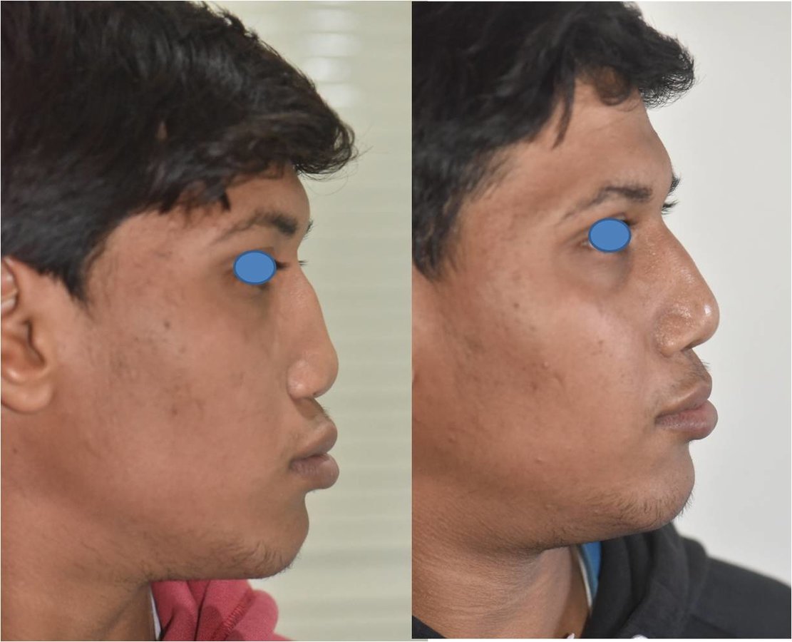 The Nose Clinic - The Nose Clinic