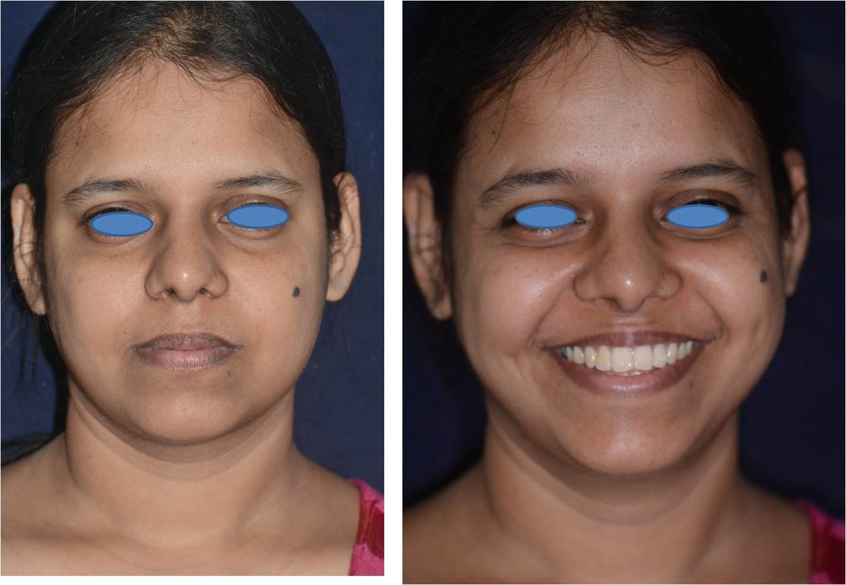 The Nose Clinic - The Nose Clinic