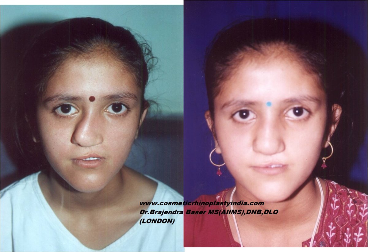 The Nose Clinic - The Nose Clinic